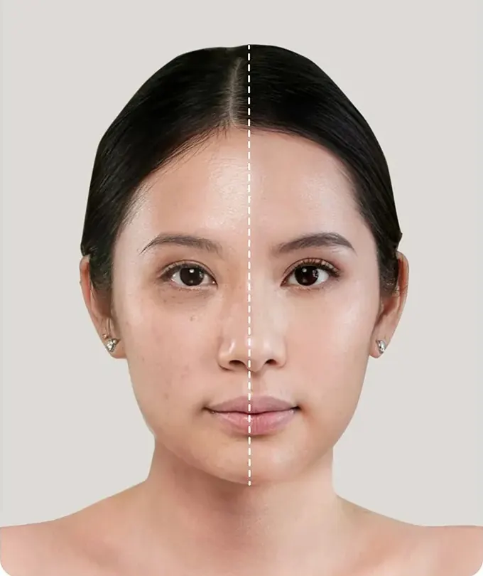 Wajah model: separuh kiri tanpa makeup dengan noda, separuh kanan memakai Perfect Blur Cushion tampak mulus