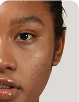 Shade Sand: wajah dengan flek sebelum memakai cushion