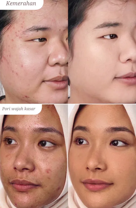 Sebelum dan sesudah Compact Powder pada kemerahan dan pori wajah kasar