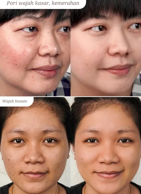 Sebelum dan sesudah Loose Powder pada pori wajah kasar, kemerahan, dan wajah kusam